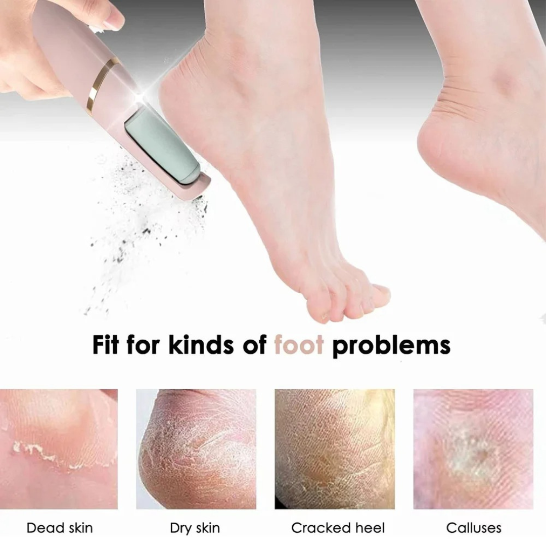 Flawless Pedi | Removedor de Callos Electrico